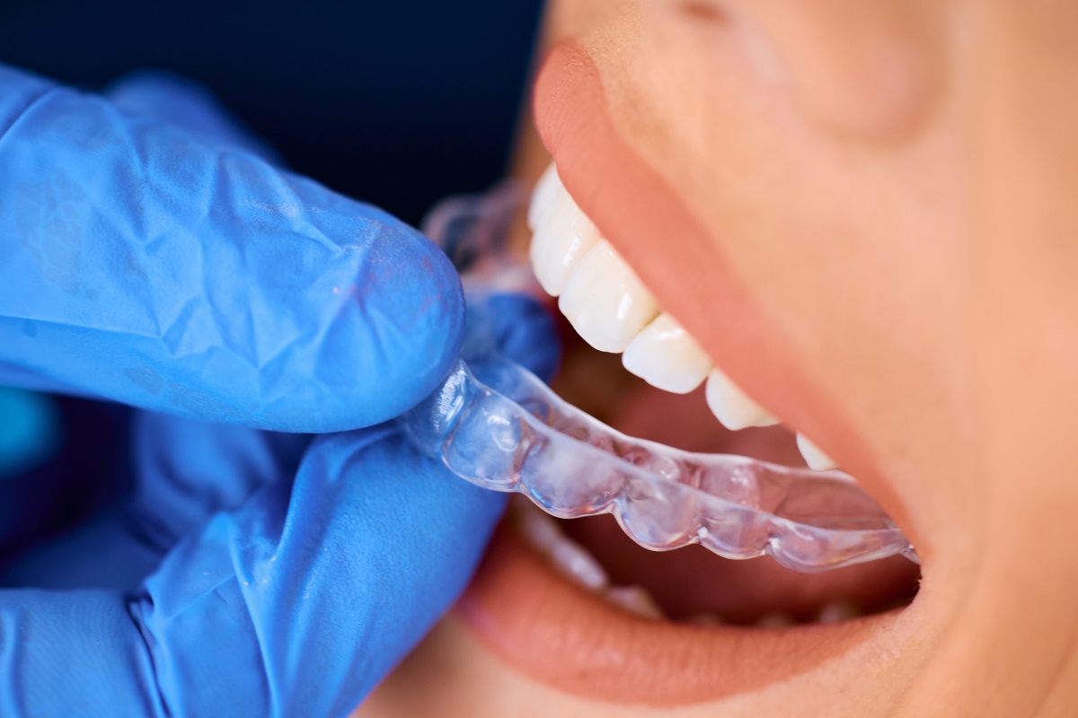 Invisalign Nashville