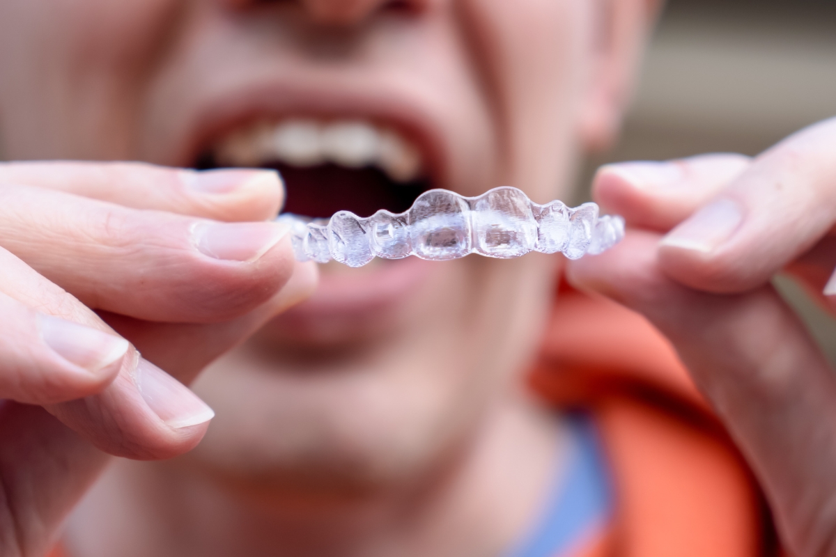 Invisalign Nashville