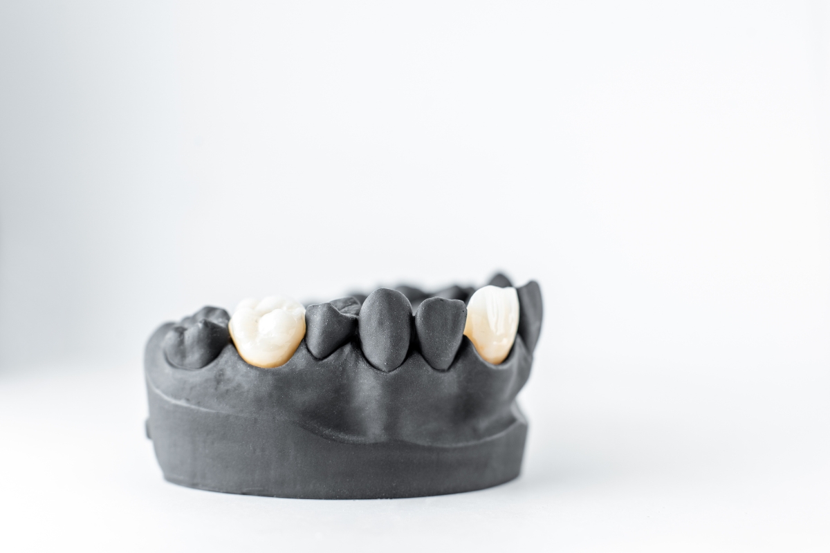 Dental Crowns Nashville